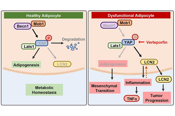 Principle of Tumor Progression Induced by Adipocytes in Obesity Identified
